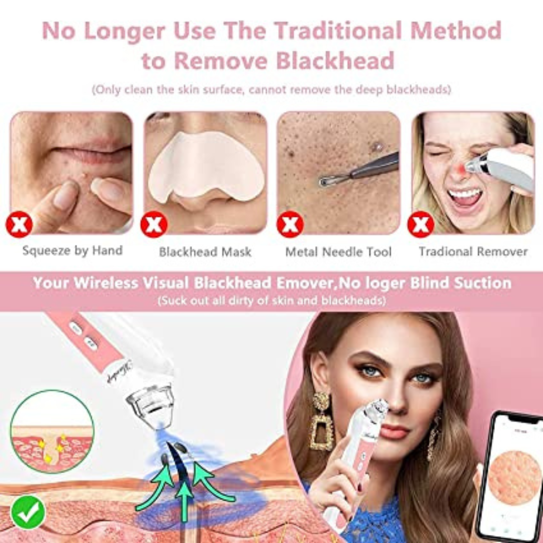 MAXSHOP Blackhead Remover Vacuum Pore Cleaner with Camera, Comedones Extractor for Facial Deep Cleansing