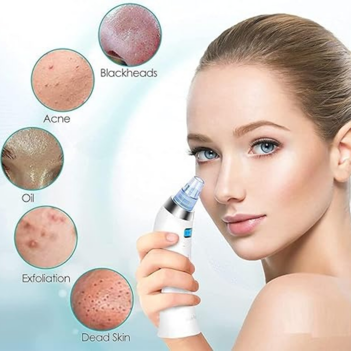 4 in 1 Multi-Function Derma Suction Pore Cleansing Vacuum