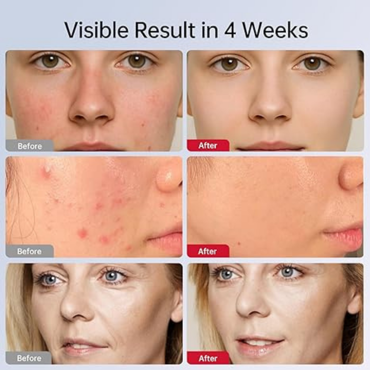 Portable 7 Color Red Light Facial Masks