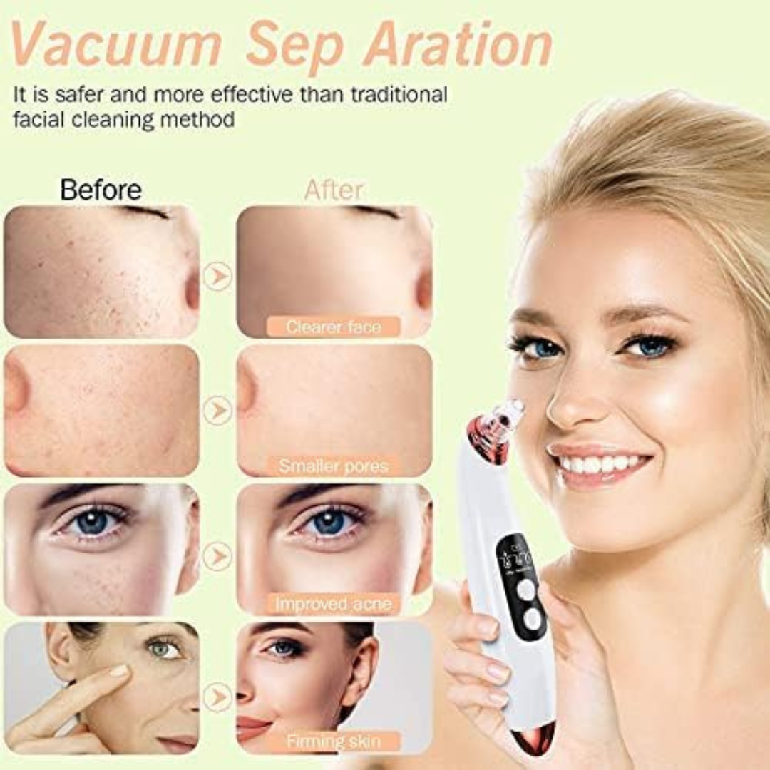 Blackhead Remover Pore Vacuum Cleaner-AMVOOM Upgraded Acne Comedone Face Cleaning Tools