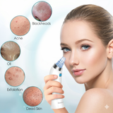 Woman using derma pore suction vacuum for blackhead removal on nose