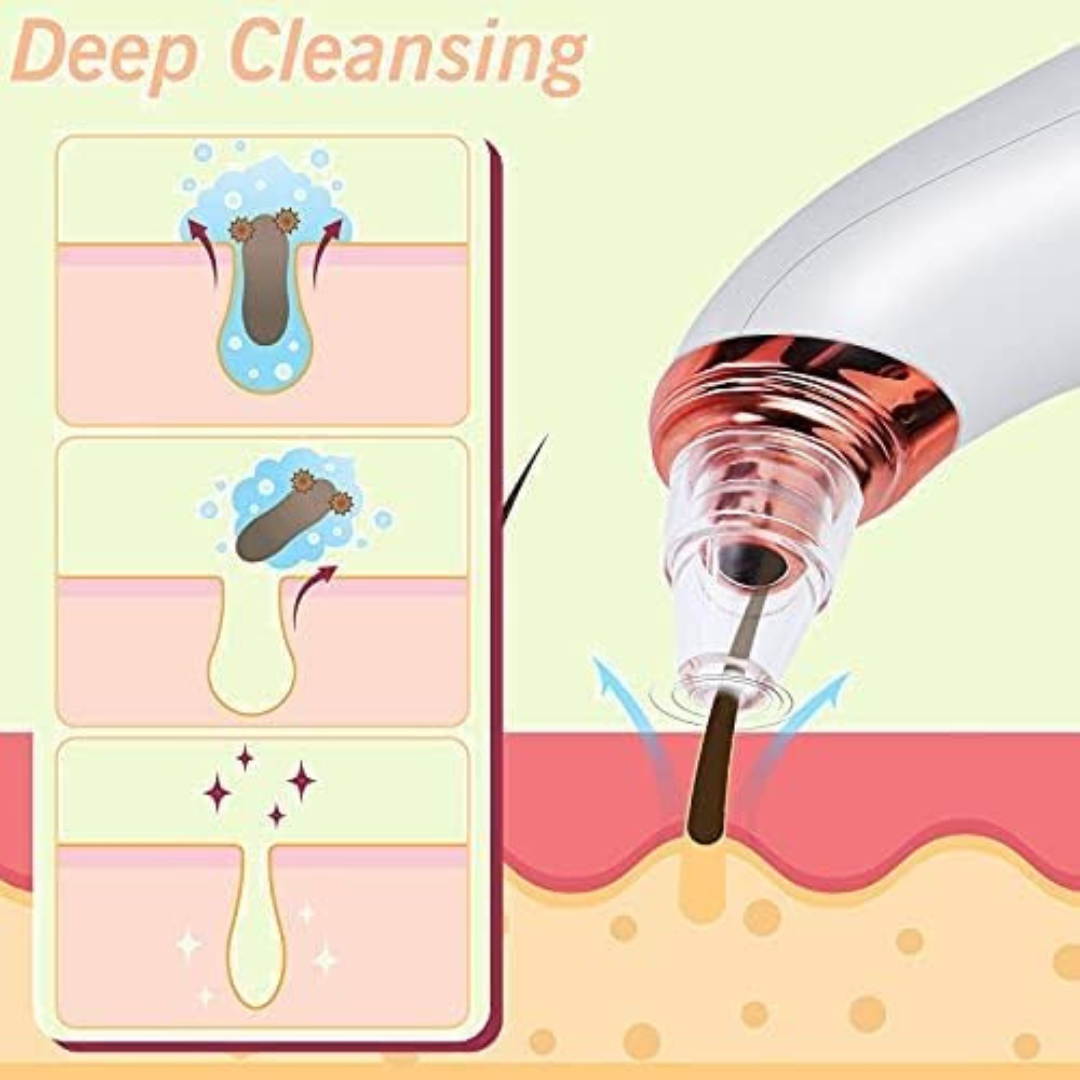 Blackhead Remover Pore Vacuum Cleaner-AMVOOM Upgraded Acne Comedone Face Cleaning Tools