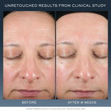 Before and after comparison of skin using Lancome Genifique Night Repair Cream. The image shows improved skin smoothness after 4 weeks.